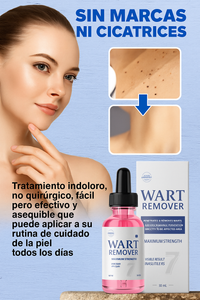 wart-remover