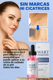 wart-remover