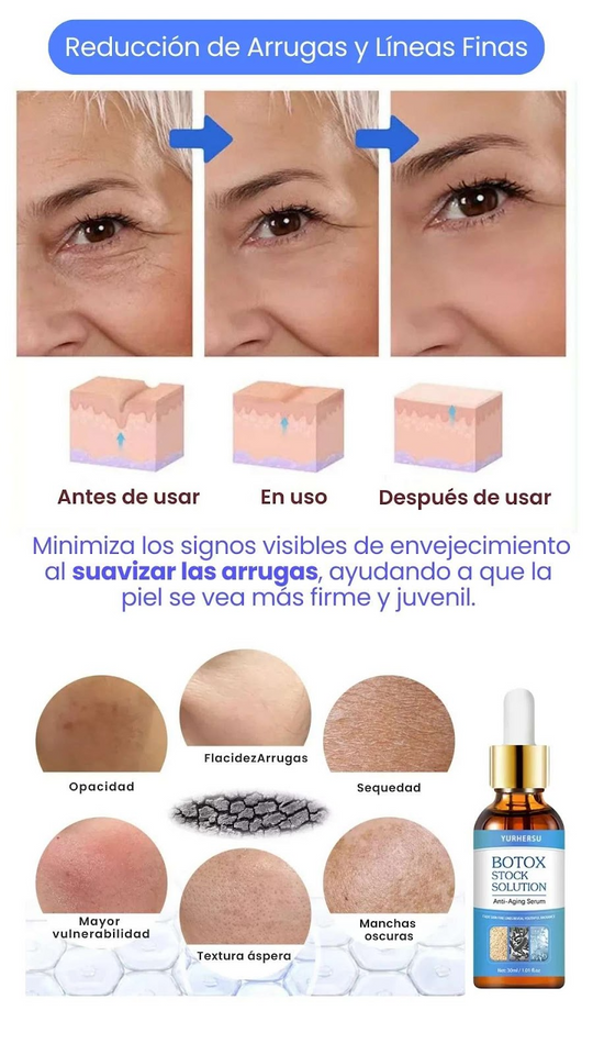 BOTOX SOLUTION