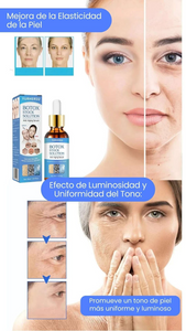 BOTOX SOLUTION