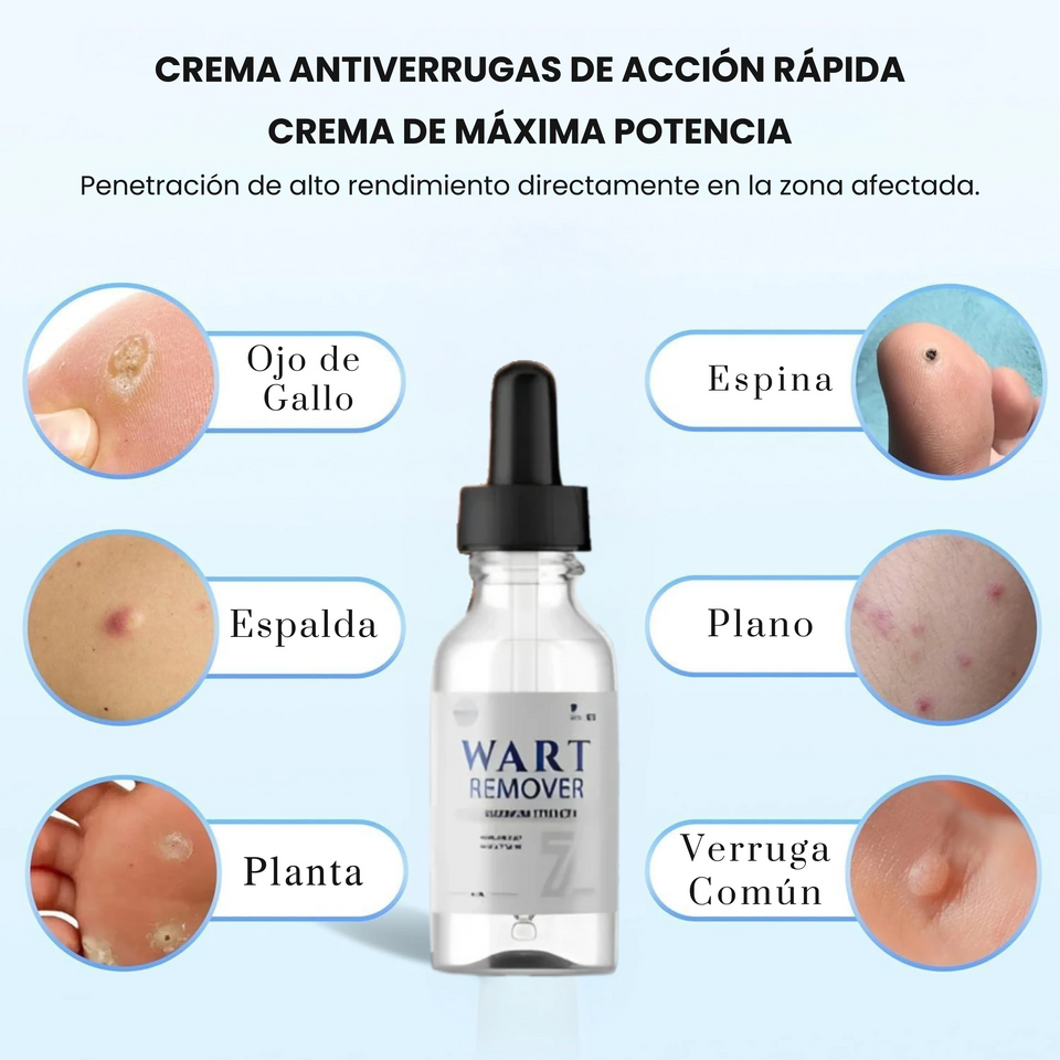 wart-remover