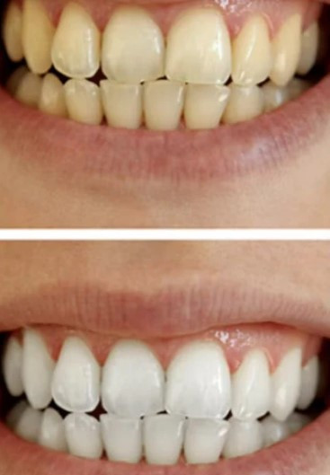 SMILEKIT