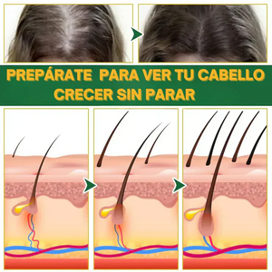 OUHOE ELIXER CAPILAR