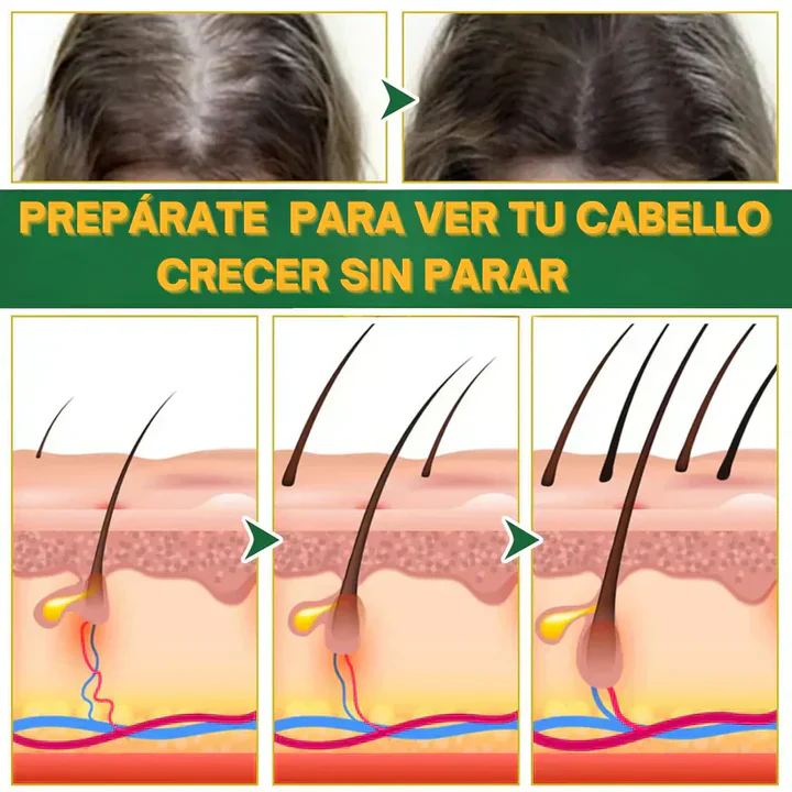 OUHOE ELIXER CAPILAR