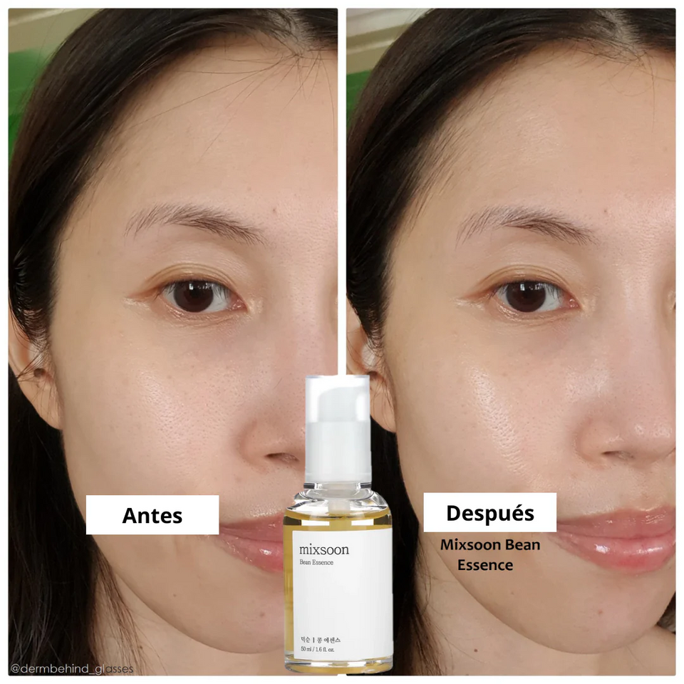 Mixsoon: Exfoliante & Hidratante Facial para Piel Grasa